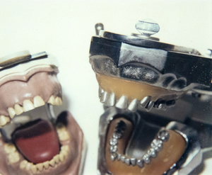 אנדי וורהול - תבניות שיניים - פולארויד, פולקולור - 3 3/8 x 4 1/4 אינץ'.